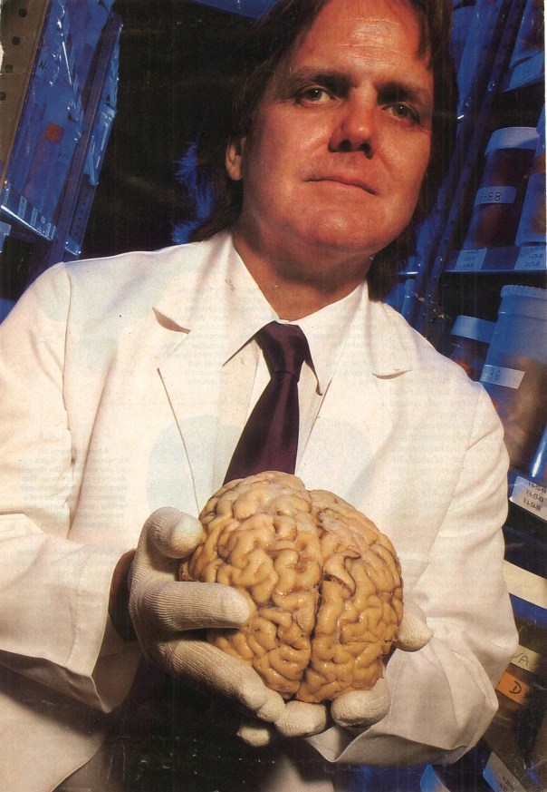 Man Holding Brain